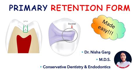 Stages Of Tooth Preparation Primary Retention Form Made Easy Youtube