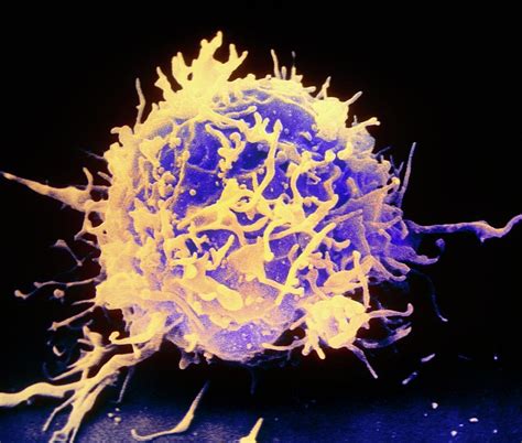 Coloured Sem Of A T Lymphocyte White Blood Cell 1 By Nibsc Science