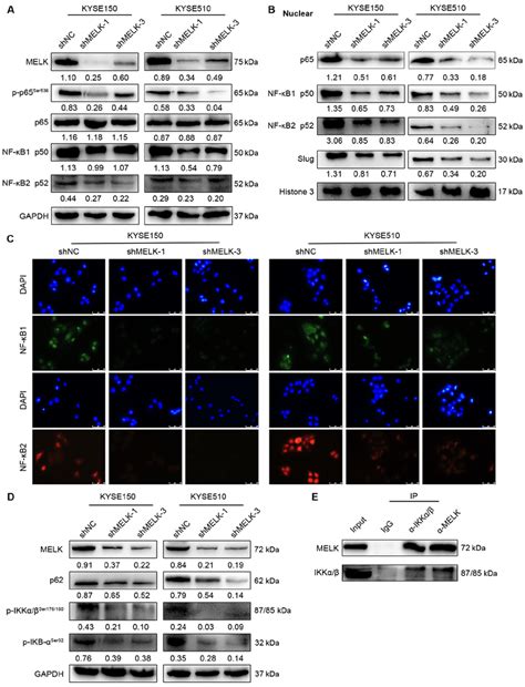 Melk Promotes Migration And Invasion Abilities Of Escc Cells By