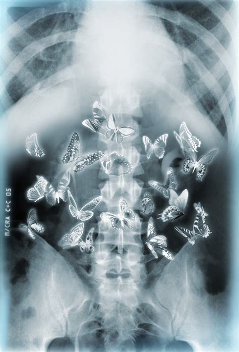 Butterflies In Your Stomach Foto And Bild Fotomontage Composing