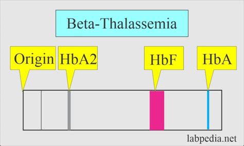 Hemoglobin Part 2 Hemoglobin Hb Electrophoresis