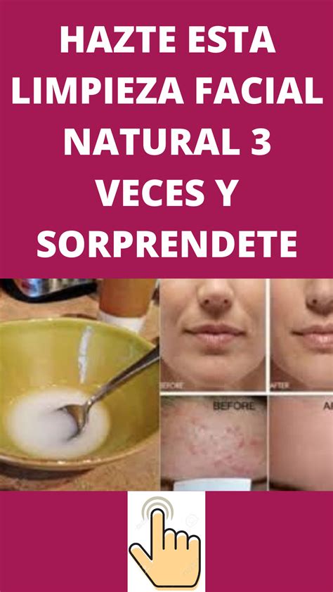 Hazte Esta Limpieza Facial Natural 3 Veces Y Sorprendete Limpieza Facial Limpieza Facial