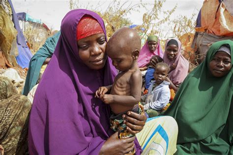 190万人の子に命の危機 アフリカ干ばつで食料不足 47news（よんななニュース）