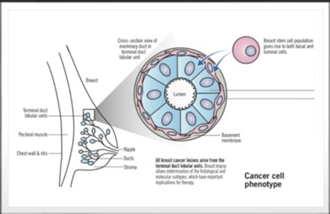 Breast Cancer Flashcards Quizlet