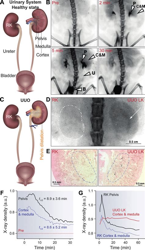 A Diagram Of Urinary System In Health State B Representative Plain Download Scientific