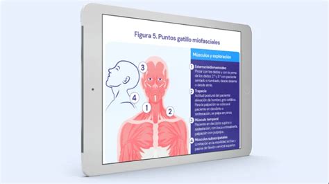 Gu A De Diagn Stico Y Tratamiento De Cefaleas En Atenci N Primaria