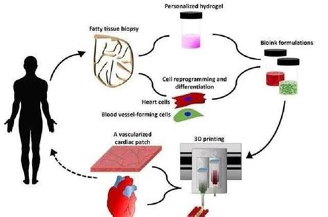 The First 3d Printed Heart In The World