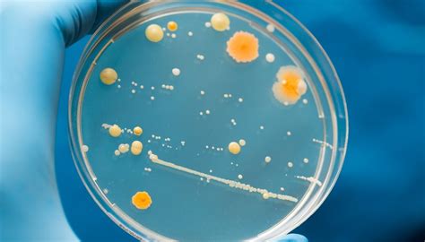 Nutritional Types Of Bacteria Sciencing