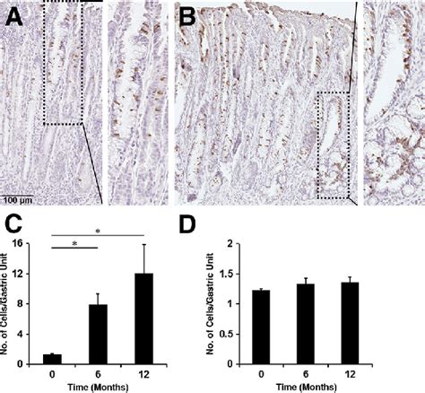 Immunohistochemistry Of Doublecortin Like Kinase 1 Dclk1 In