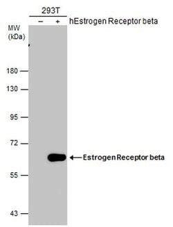 estrogen receptor beta monoclonal antibody  invitrogen  mg