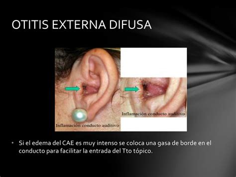 Ppt Patologia Otica Powerpoint Presentation Free Download Id3383394