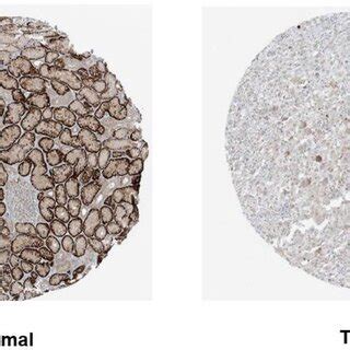 Mitd Mrna Expression Levels In Normal And Cancer Tissues A Human