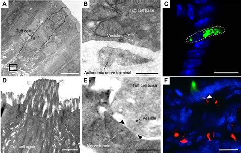 Dclk1 Expressing Tuft Cells Critical Modulators Of The Intestinal