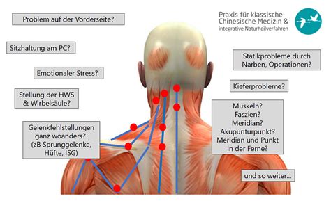 Nackenschmerzen TCM Akupunktur Osteopathie FDM