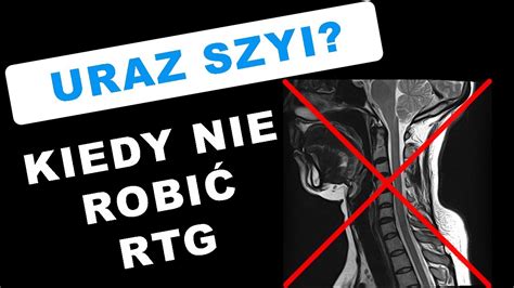 B L Kr Gos Upa Szyjnego Po Urazie Kiedy Wykona Badanie Rtg Test