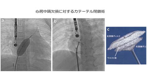 循環器部門 診療内容 倉敷中央病院