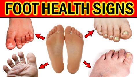 What Your Feet Can Tell You About Your Health Youtube