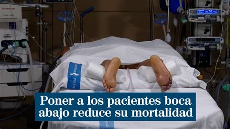 Poner a los pacientes boca abajo reduce la necesidad de intubación y su