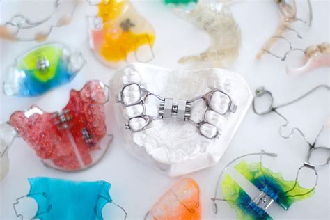 Appareil Dentaire Les Differents Types Orthodontiepourtous