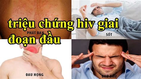 TriỆu ChỨng Hiv Giai ĐoẠn ĐẦu Ở Nam GiỚi Youtube