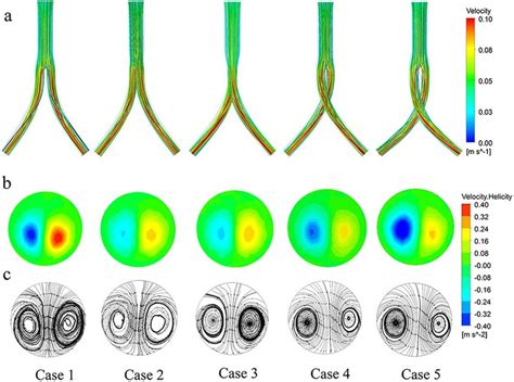 Steady State Flow Patterns For All Five Cases A Streamlines Colored