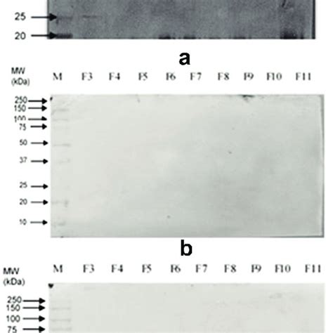 Western Blot Analysis On Entamoeba Histolytica Membrane Proteins