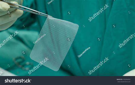 434 Hernia mesh Images, Stock Photos & Vectors | Shutterstock