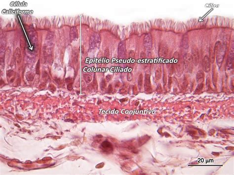 Tecido Epitelial Da Traqueia Braincp