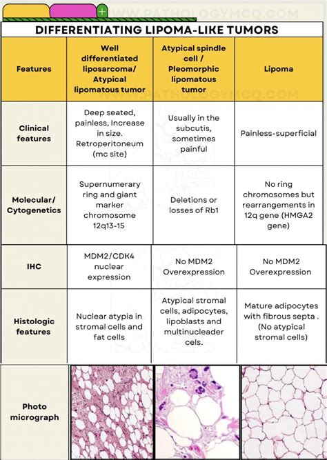 Differentiation Table Summarizing The Differences Between Lipoma Atypical Spindle Cell