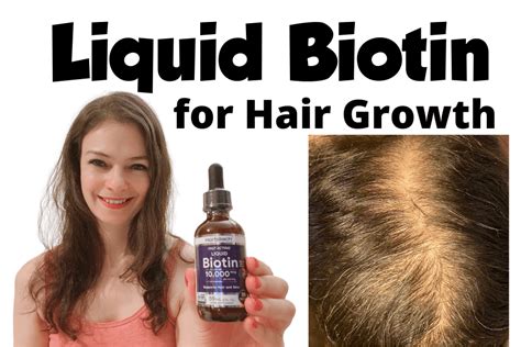 Liquid Biotin For Hair Growth Does It Work