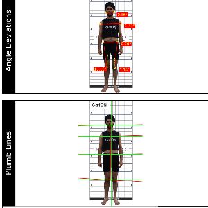 Posture Analysis System_ Plumb Lines & Postural Deviations - auptimo