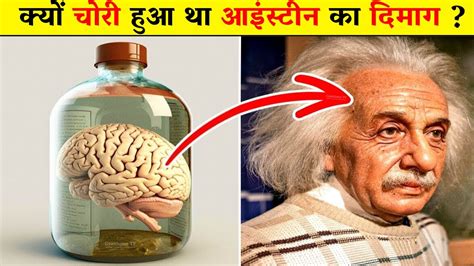 How Einstein S Brain Was Different