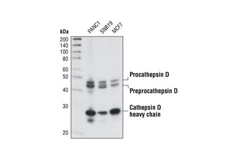 Cathepsin D Antibody | Cell Signaling Technology