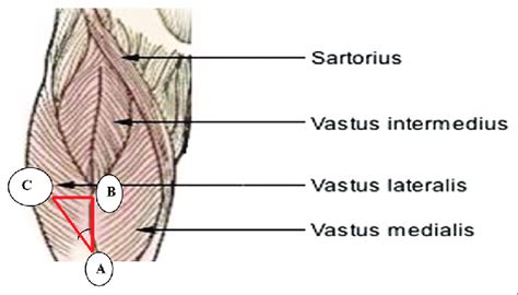 Vastus Lateralis Muscle Architectural Parameters Are Represented In Download Scientific Diagram