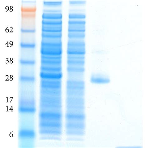 Optimization Of Protein Expression Lane M Seeblue Plus Pre Stained