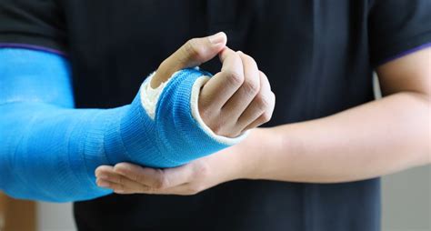 What To Expect During Broken Arm Recovery Oc Sports And Rehab