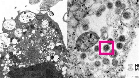 香港专家许树昌：omicron的杀伤力和死亡率较delta轻