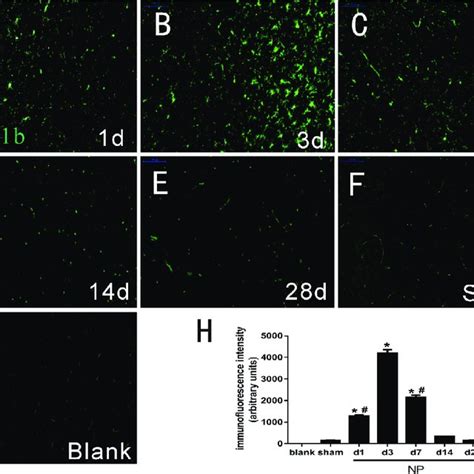 Autologous Nucleus Pulposus NP Induces Time Dependent Activation Of