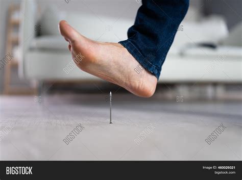 Foot Pin Accident Image And Photo Free Trial Bigstock