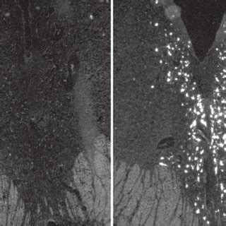 Dark Field ISH Photomicrographs Showing The Distribution Of NNOS A