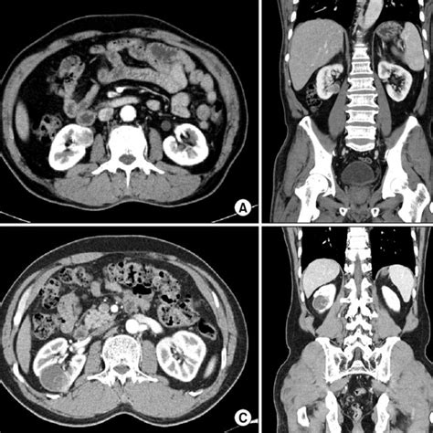 The Representative Preoperative Computed Tomography Images A B Download Scientific Diagram