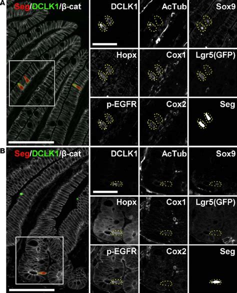 Expression of tuft cell markers in the small intestine. Representative ...