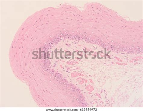 Histology Human Intestine Show Epithelium Tissue Stock Photo 619354973 ...