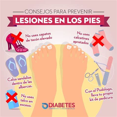 7 Aliados Para Cuidar Tus Pies Diabetes Salud Y Nutricion Y Podología