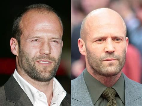 Celebrities Who Are Now Rocking The Bald Look Bald Men Style Bald