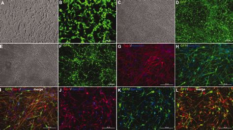 Efficient Transduction Of Induced Pluripotent Stem Cell Ipsc Derived