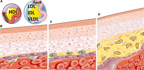 Frontiers Sex Differences In Lipid Metabolism Implications For