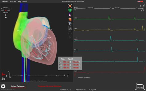 Epicardio Simulation Research And Development