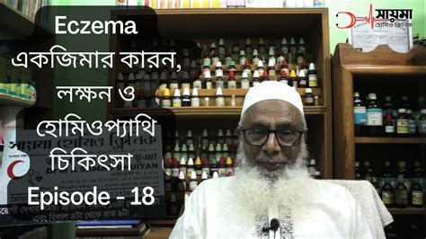 Eczema একজিমার কারন লক্ষন ও হোমিওপ্যাথি চিকিৎসা Episode 18 Saima