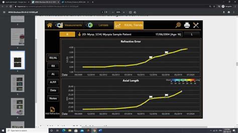 Topcon MYAH Myopia Management Saturn Optical